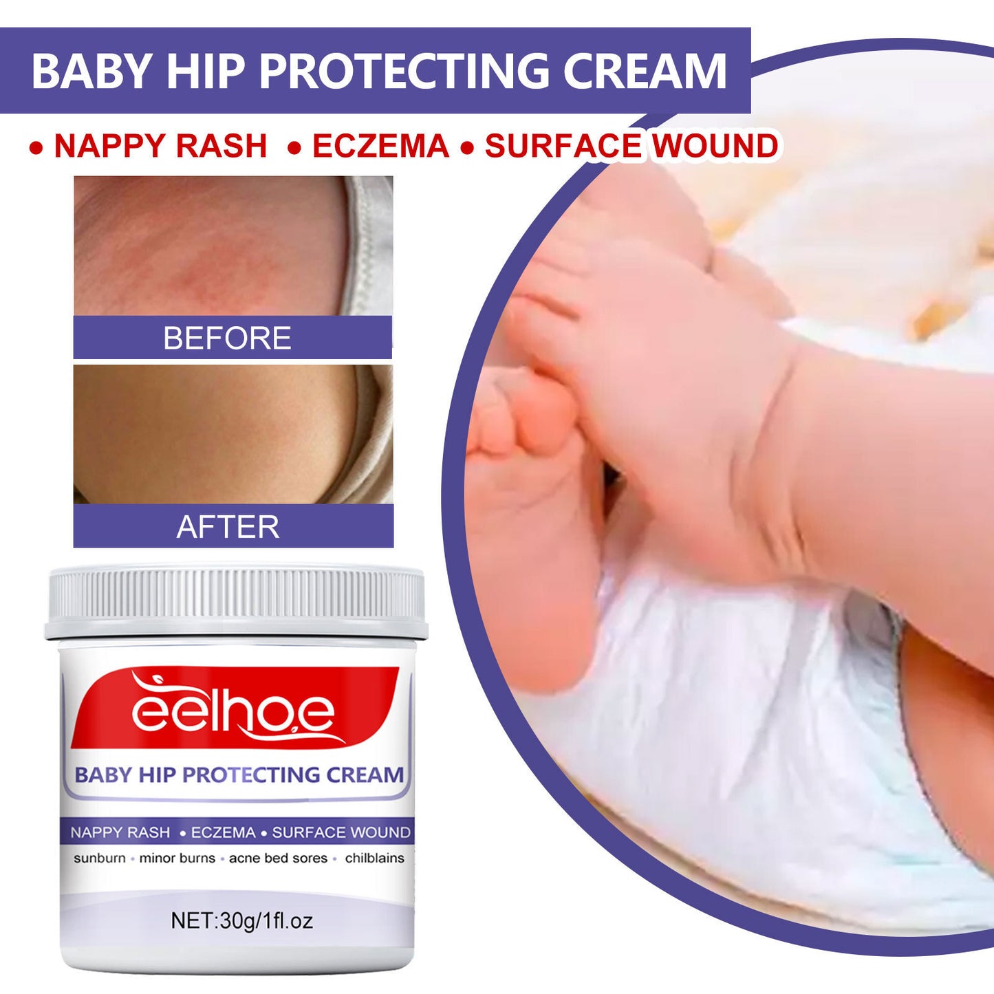 Baby Hip Moisturizing Skin Repair Neck Cream.