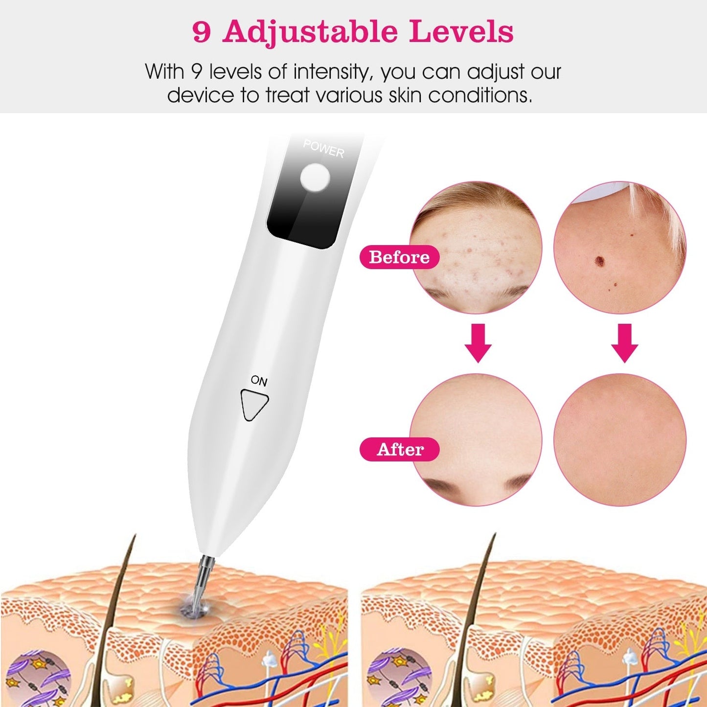 2 PCS Skin Rash Repair Kit Alicewonder